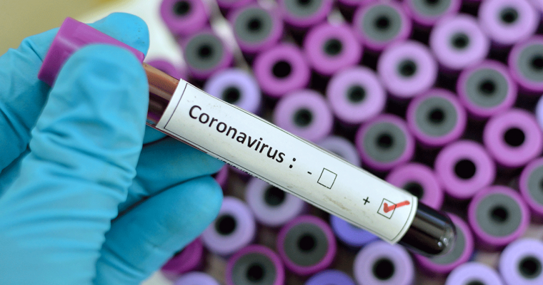 Update Corona-virus / COVID-19